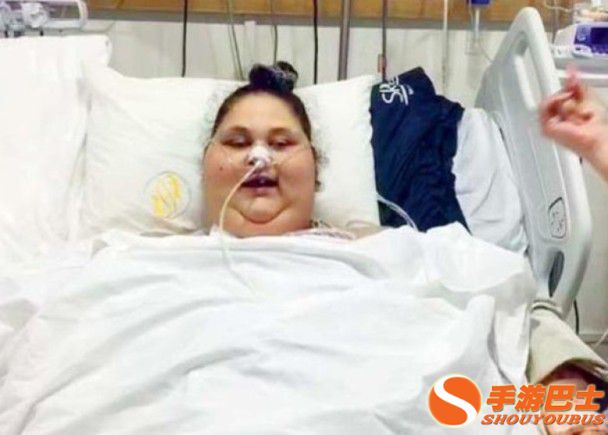 最重女减肥500斤 肥胖原因曝光令人震惊（组图）